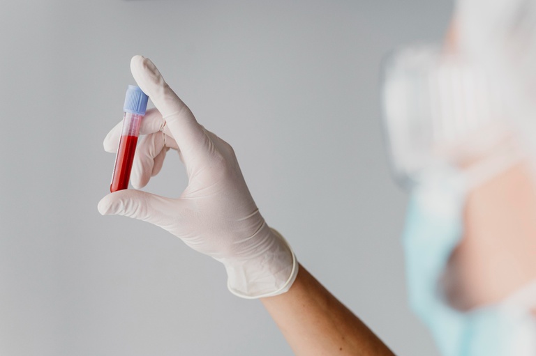 infectologista da HU Brasil explica transmissão, sintomas e prevenção — Agência Gov